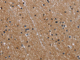 GAB2 Polyclonal Antibody Store at -20°C