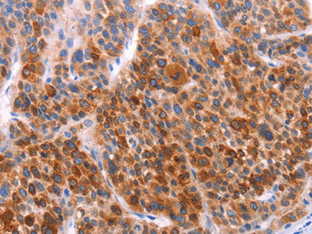 AADAC Polyclonal Antibody Store at -20°C