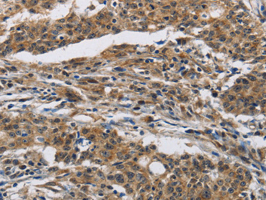IFNGR2 Polyclonal Antibody Store at -20°C