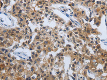 PDCD7 Polyclonal Antibody Store at -20°C