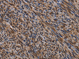 KIF1C Polyclonal Antibody Store at -20°C