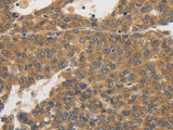 PRKD1 Polyclonal Antibody Host Rabbit