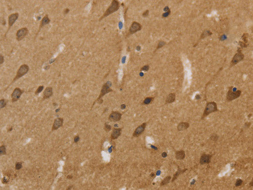KCNN4 Polyclonal Antibody Store at -20°C