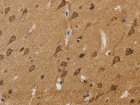 KCNN4 Polyclonal Antibody Store at -20°C