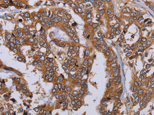 MFAP3L Polyclonal Antibody Store at -20°C