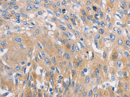 NBEA Polyclonal Antibody