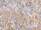 NBEA Polyclonal Antibody
