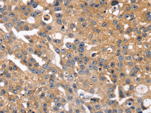 SLC2A2 Polyclonal Antibody Store at -20°C