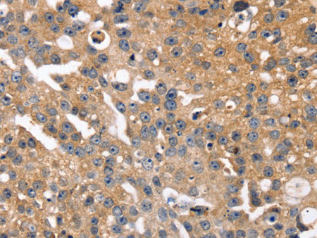 SLC2A2 Polyclonal Antibody Store at -20°C