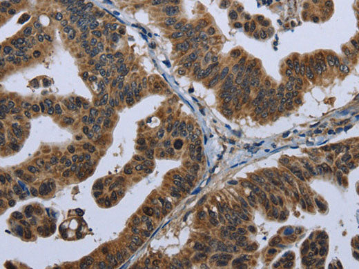 GPAM Polyclonal Antibody Store at -20°C