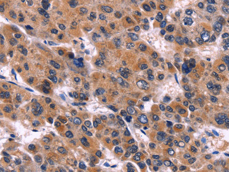 EIF2AK4 Polyclonal Antibody Store at -20°C