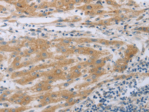 TNK2 Polyclonal Antibody Store at -20°C