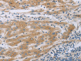 TNK2 Polyclonal Antibody Store at -20°C