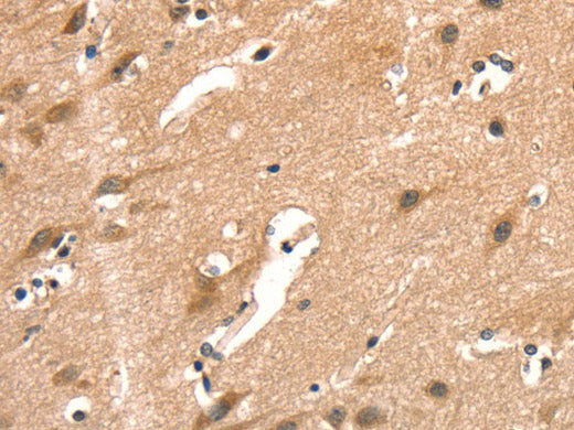 AIMP1 Polyclonal Antibody Store at -20°C