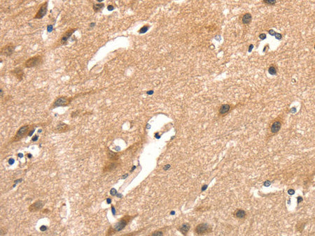 AIMP1 Polyclonal Antibody Store at -20°C