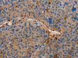 AMBRA1 Polyclonal Antibody