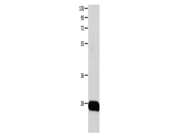 POMC Polyclonal Antibody Store at -20°C