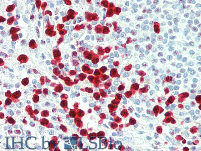 S100A12 Polyclonal Antibody Store at -20°C