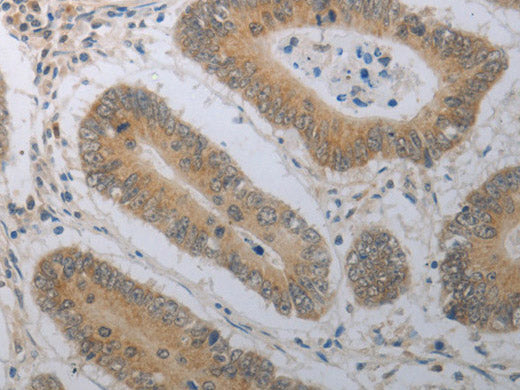 SHH Polyclonal Antibody Store at -20°C