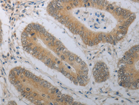 SHH Polyclonal Antibody Store at -20°C