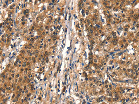 DDX4 Polyclonal Antibody Store at -20°C