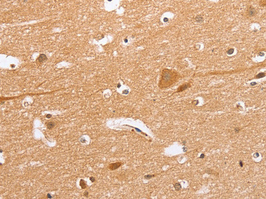 BLNK Polyclonal Antibody Store at -20°C