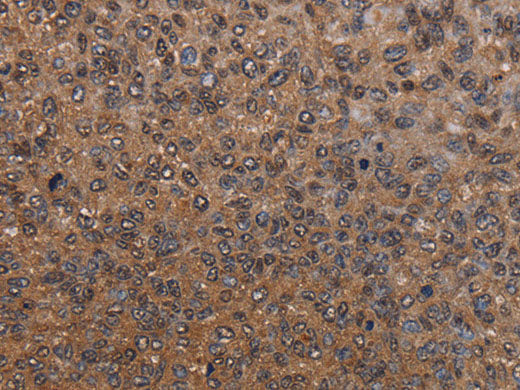 HYAL2 Polyclonal Antibody Store at -20°C