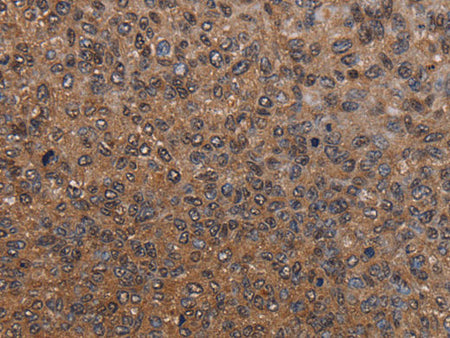 HYAL2 Polyclonal Antibody Store at -20°C