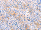 EDG6 Polyclonal Antibody