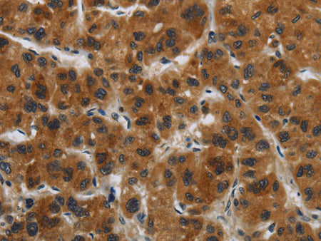 GATA5 Polyclonal Antibody Store at -20°C