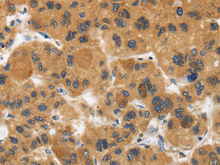 CALU Polyclonal Antibody Store at -20°C