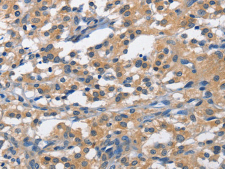 PIM1 Polyclonal Antibody Store at -20°C