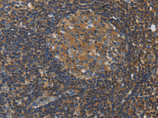 RAD54L2 Polyclonal Antibody Store at -20°C