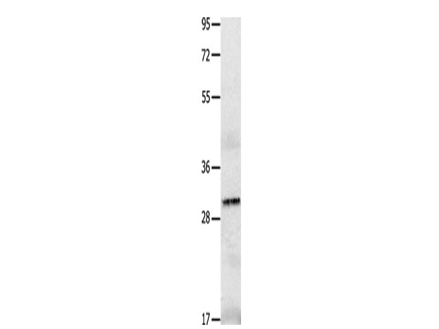 IL2RA Polyclonal Antibody