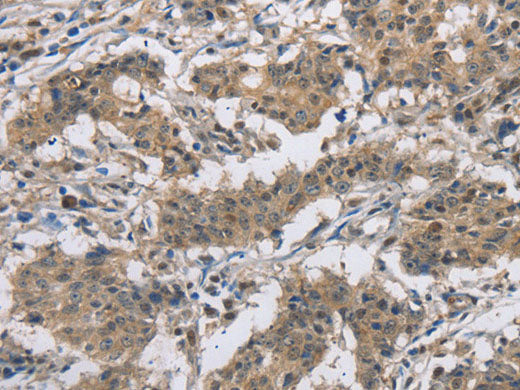 DSG2 Polyclonal Antibody Store at -20°C