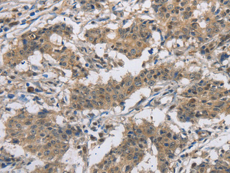 DSG2 Polyclonal Antibody Store at -20°C
