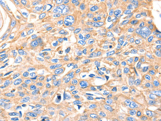 MVP Polyclonal Antibody Store at -20°C