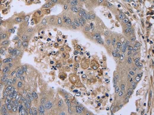 FAP Polyclonal Antibody Store at -20°C