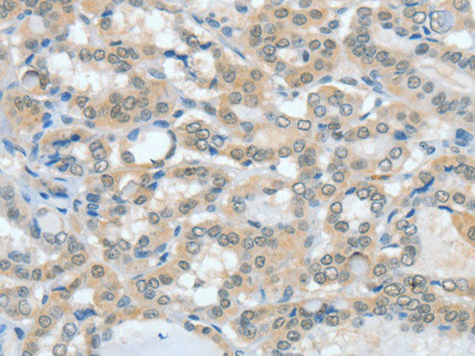 ASH2L Polyclonal Antibody Store at -20°C