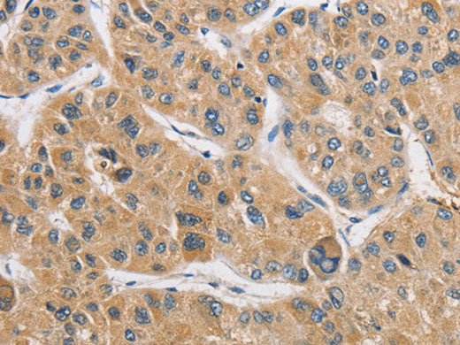 ARHGAP15 Polyclonal Antibody Store at -20°C