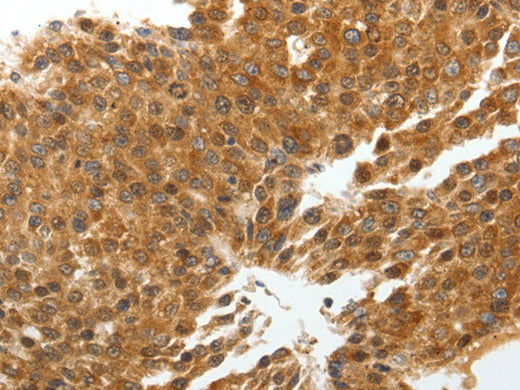 TNXB Polyclonal Antibody Store at -20°C