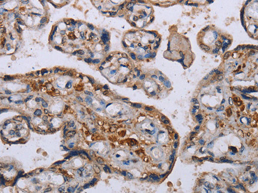 P3H3 Polyclonal Antibody Store at -20°C