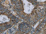 NDUFA5 Polyclonal Antibody Store at -20°C