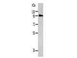 AKAP8 Polyclonal Antibody Store at -20°C