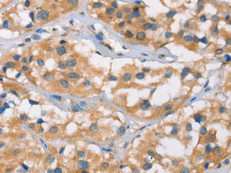 DSC2 Polyclonal Antibody Store at -20°C