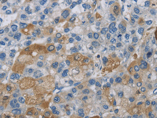 DNAJB4 Polyclonal Antibody Store at -20°C