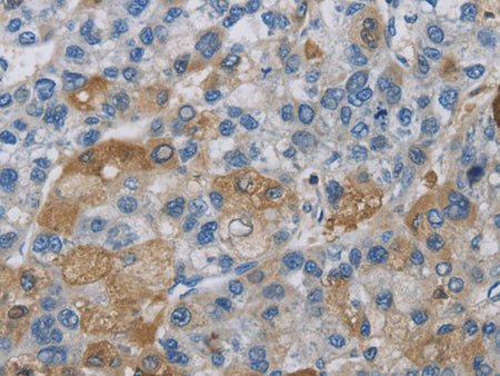 DNAJB4 Polyclonal Antibody Store at -20°C