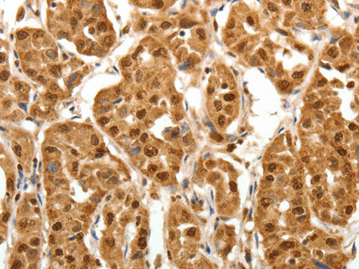 TNN Polyclonal Antibody Store at -20°C