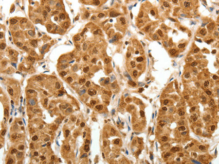TNN Polyclonal Antibody Store at -20°C