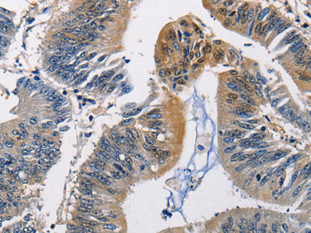 PGK1 Polyclonal Antibody Store at -20°C